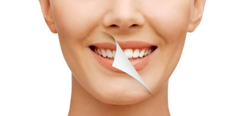 Smile Makeover Cosmetic Dentistry