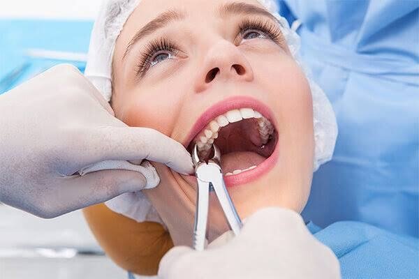 Painless Tooth Extraction